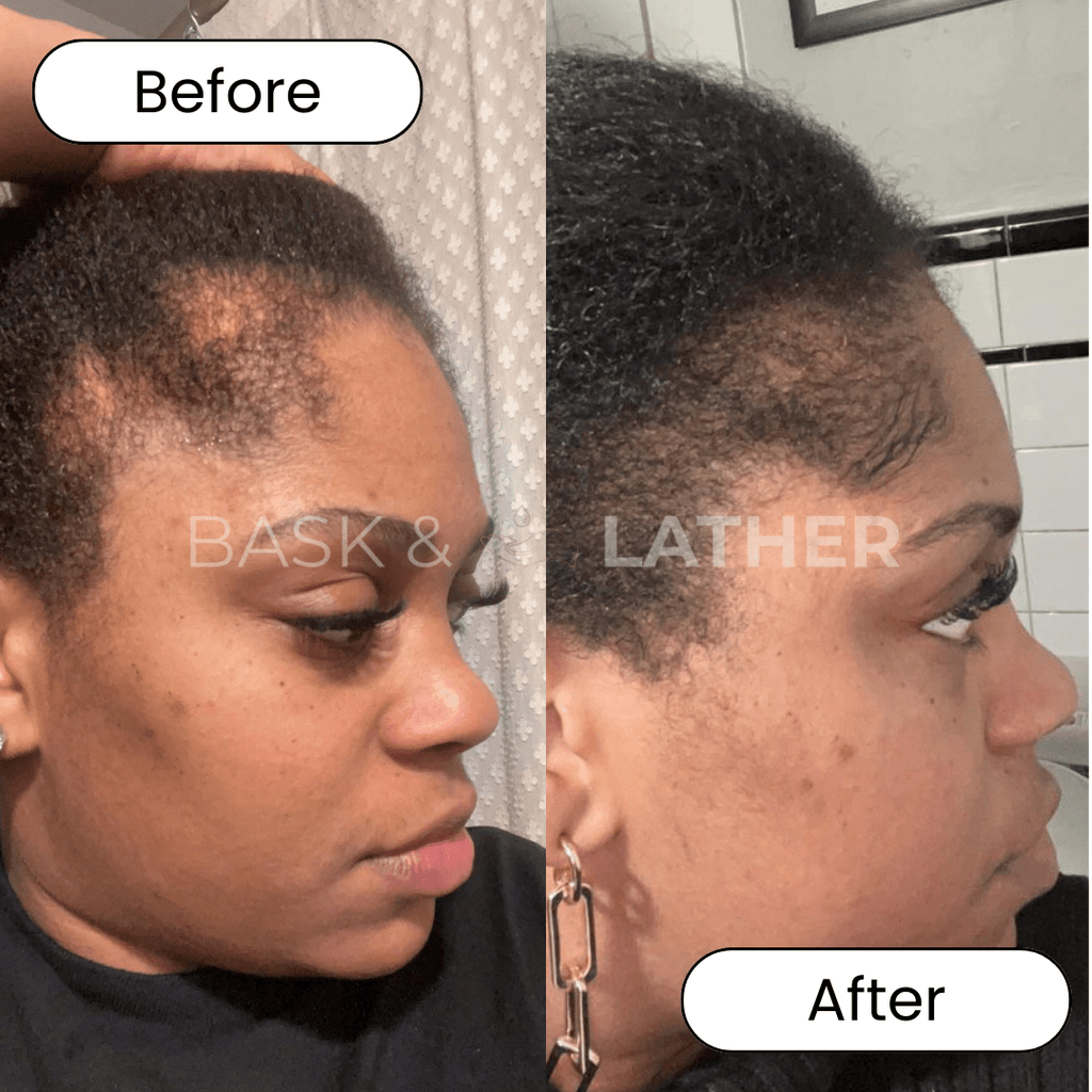 XL Cleanse & Growth Bundle - For Moisture & Hydration